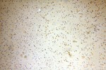 MTA3 Antibody in Immunohistochemistry (Paraffin) (IHC (P))