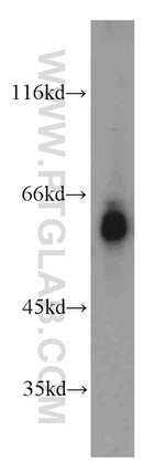 MTA3 Antibody in Western Blot (WB)