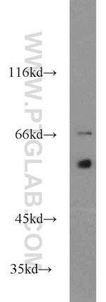 MTA3 Antibody in Western Blot (WB)