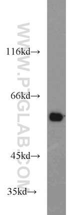 MTA3 Antibody in Western Blot (WB)