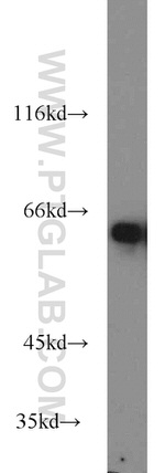 MTA3 Antibody in Western Blot (WB)