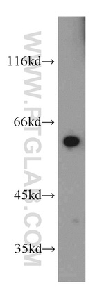 MTA3 Antibody in Western Blot (WB)