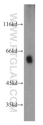 MTA3 Antibody in Western Blot (WB)