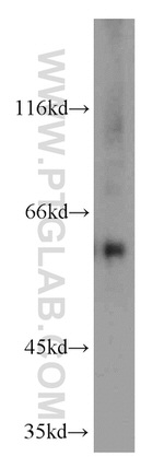 MTA3 Antibody in Western Blot (WB)