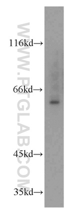 MTA3 Antibody in Western Blot (WB)