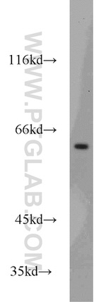 MTA3 Antibody in Western Blot (WB)