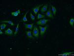 NBAS Antibody in Immunocytochemistry (ICC/IF)