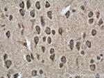 NBAS Antibody in Immunohistochemistry (Paraffin) (IHC (P))