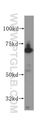 PAK4 Antibody in Western Blot (WB)