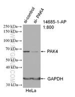 PAK4 Antibody in Western Blot (WB)