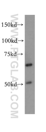 PAK4 Antibody in Western Blot (WB)