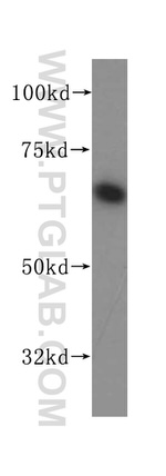 PAK4 Antibody in Western Blot (WB)