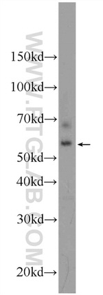 PAK4 Antibody in Western Blot (WB)