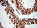 CRMP2 Antibody in Immunohistochemistry (Paraffin) (IHC (P))