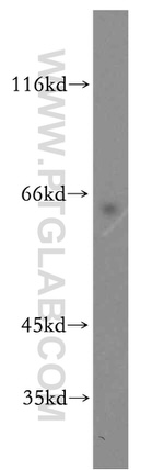 CRMP2 Antibody in Western Blot (WB)