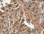 SLC44A1 Antibody in Immunohistochemistry (Paraffin) (IHC (P))