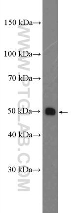 SLC44A1 Antibody in Western Blot (WB)