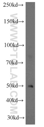 SLC44A1 Antibody in Western Blot (WB)