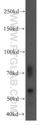 SLC44A1 Antibody in Western Blot (WB)