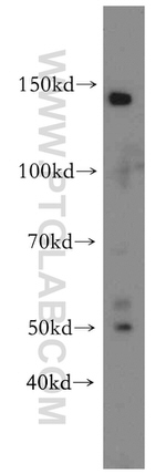 SLC44A1 Antibody in Western Blot (WB)