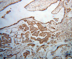 DIS3 Antibody in Immunohistochemistry (Paraffin) (IHC (P))