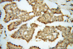 DIS3 Antibody in Immunohistochemistry (Paraffin) (IHC (P))