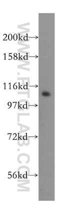 DIS3 Antibody in Western Blot (WB)