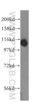 DIS3 Antibody in Western Blot (WB)