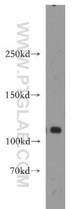 DIS3 Antibody in Western Blot (WB)