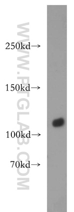 DIS3 Antibody in Western Blot (WB)