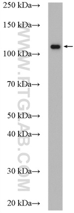 DIS3 Antibody in Western Blot (WB)