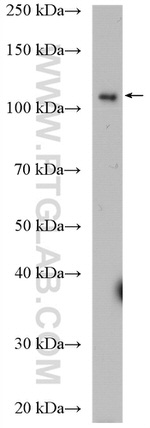 DIS3 Antibody in Western Blot (WB)