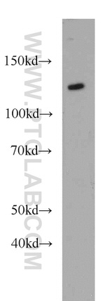 AGAP2 Antibody in Western Blot (WB)