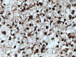 AGAP2 Antibody in Immunohistochemistry (Paraffin) (IHC (P))