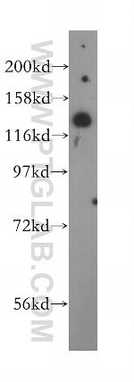 AGAP2 Antibody in Western Blot (WB)
