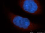 THEM4 Antibody in Immunocytochemistry (ICC/IF)