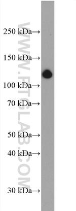 Collagen Type I Antibody in Western Blot (WB)