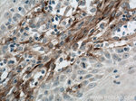 Collagen Type I Antibody in Immunohistochemistry (Paraffin) (IHC (P))