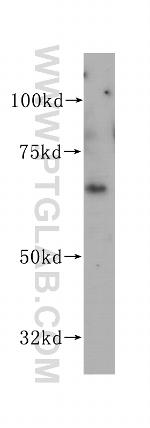 VANGL1 Antibody in Western Blot (WB)