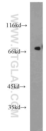 KCNAB1 Antibody in Western Blot (WB)
