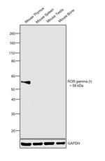 ROR gamma (t) Antibody