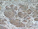 GRP94 Antibody in Immunohistochemistry (Paraffin) (IHC (P))