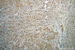 GRP94 Antibody in Immunohistochemistry (Paraffin) (IHC (P))