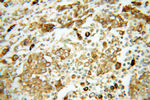 GRP94 Antibody in Immunohistochemistry (Paraffin) (IHC (P))