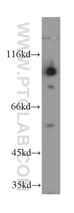 GRP94 Antibody in Western Blot (WB)