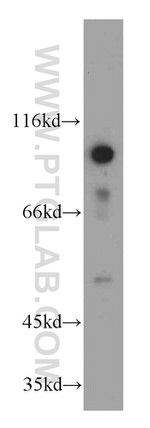 GRP94 Antibody in Western Blot (WB)