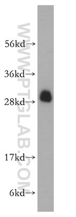 RPL19 Antibody in Western Blot (WB)