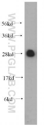 RPL19 Antibody in Western Blot (WB)