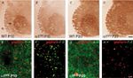 IL-1 alpha Antibody in Immunohistochemistry (IHC)