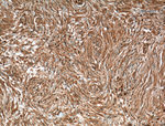 MGEA5 Antibody in Immunohistochemistry (Paraffin) (IHC (P))